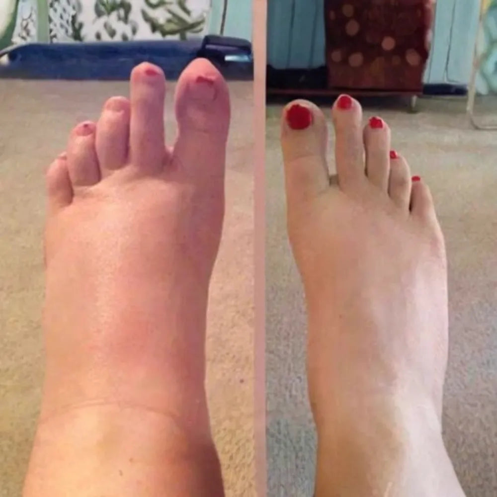 VitalSocks - Die #1 Wahl für werdende Mamas